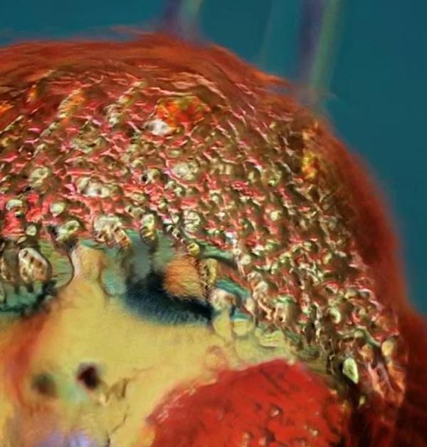 Een afbeelding uit de expo Picture Perfect over schoonheidsidealen.